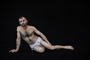 Hawar Mohammad Abdullah was born in 1985 and has been a Peshmerga since 2000. Hawar was wounded on two separate occasions while fighting ISIS. In April 2015, in Mara village in Kirkuk province, he was shot. Less than an hour later he was wounded again by an IED (improvised explosive device). It took 6 months of treatment before he would recover, at which point he went back to the frontlines. The second time Hawar was wounded was in September 2017. While fighting in the village of Abo Mohammad in Kirkuk province he was again wounded by an IED. The explosion left him in a coma for 33 days. His wife, who was pregnant, suffered a heart attack and died, which he attributes to the stress she endured following his second injury. The injuries left HawarÕs body battered and scared. He lost his left ear and left eye and after 5 surgeries he has recovered only 50% of his sight in his right eye. He has also lost his Duodenum and more than 200 pieces of shrapnel remain in his body. Life is hard for Hawar, with three kids he struggles to manage their needs despite receiving 100% disability designation. With more treatment needed, he hopes the government will help to ensure that he does not have to have his leg amputated. This is just one of the more than 10,000 Peshmerga were wounded in the against ISIS.